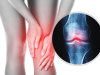 phòng khám xương khớp tại TPHCM