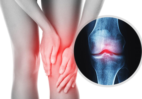 phòng khám xương khớp tại TPHCM