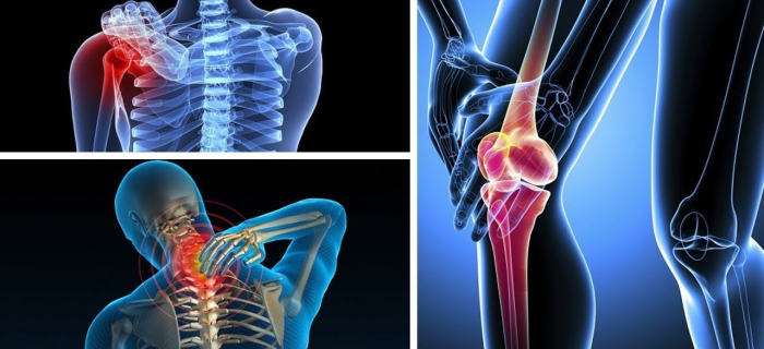 cách điều trị đau vai gáy hiệu quả