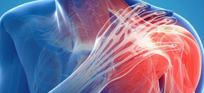 Đau khớp bả vai là dấu hiệu của bệnh gì và cách phòng ngừa-14-15-16-17